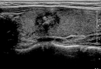 °©»ó¼± ¾Ç¼ºÁ¾¾ç